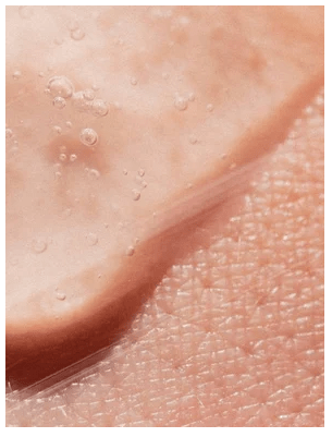 Närbild av hud med vatendroppar som visar effekten av AHA Peeling Concentrate - mjuk, förnyad hudtextur