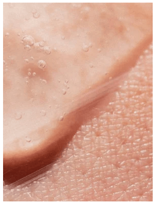 Närbild på hud med vatendroppar som visar hudens naturliga textur och fuktighet