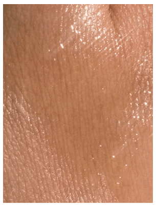 Glänsande hud med fuktig, genomskinlig textur som visar effekten av Nourishing Facial Oil 30 ml
