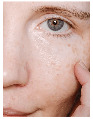 Kvinna applicerar hudkräm under ögat, visar mjuk hudstruktur och naturlig glöd från Anti-Age Day Cream
