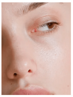 Närbild på kvinnas ansikte med strålande hud efter användning av Retinol Alternative Moisturiser hudvård