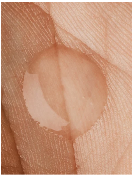 Tuplakosteuttava geeli + hyaluronihappo